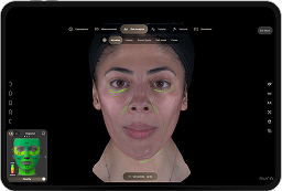 Aura Skin Analysis consultation image