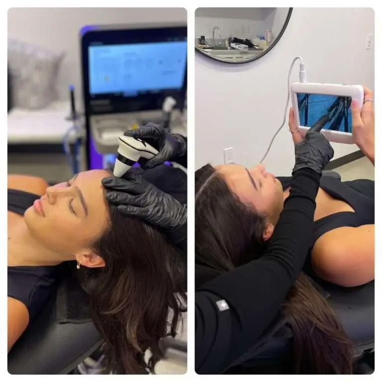 HydraScalp video scalp consultation and scalp imaging