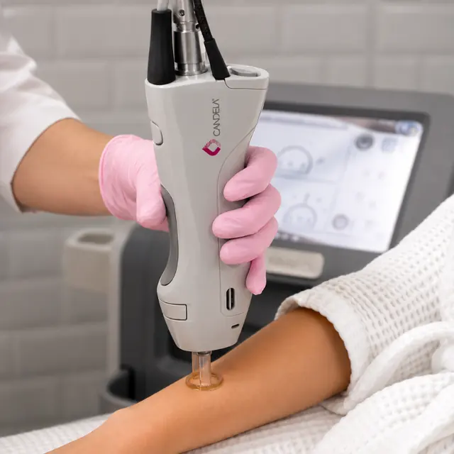 Laser hair removal area illustration for lower arms